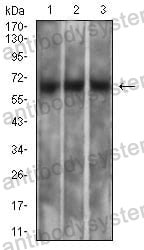 Western blot for Anti-MSLN/Mesothelin Antibody (R3S44) ?>