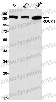 Anti-ROCK1 Antibody (R2E39)