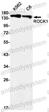 Anti-ROCK1 Antibody (R2E38)