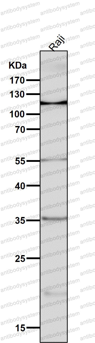 Anti-NFATC2 Antibody (R2E40)