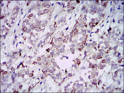 Immunohistochemical for Anti-GAB1 Antibody (R3S54) ?>