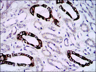 Immunohistochemical for Anti-GAB1 Antibody (R3S54) ?>