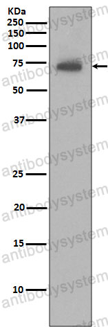 Anti-BIRC3/IAP2 Antibody (R1A77)