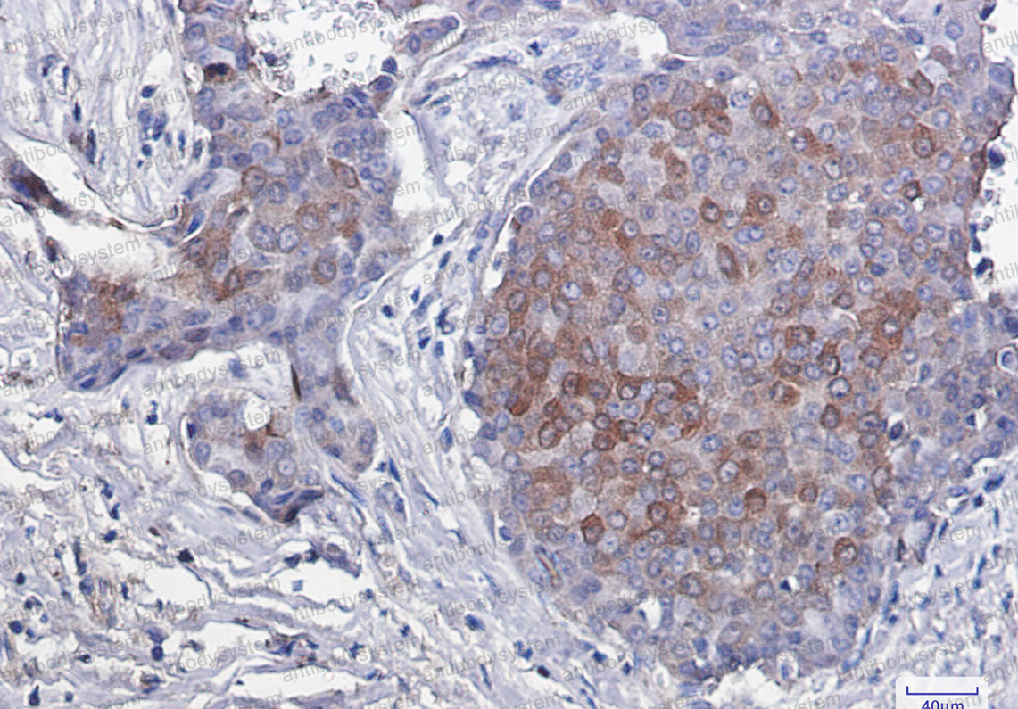 Anti-Phospho-EIF4EBP1 (Thr46) Antibody (R2E53)