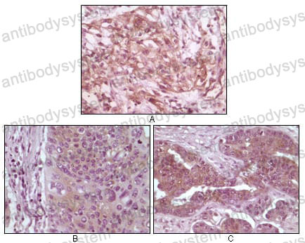 Anti-EIF4EBP1 Antibody (R3S65)