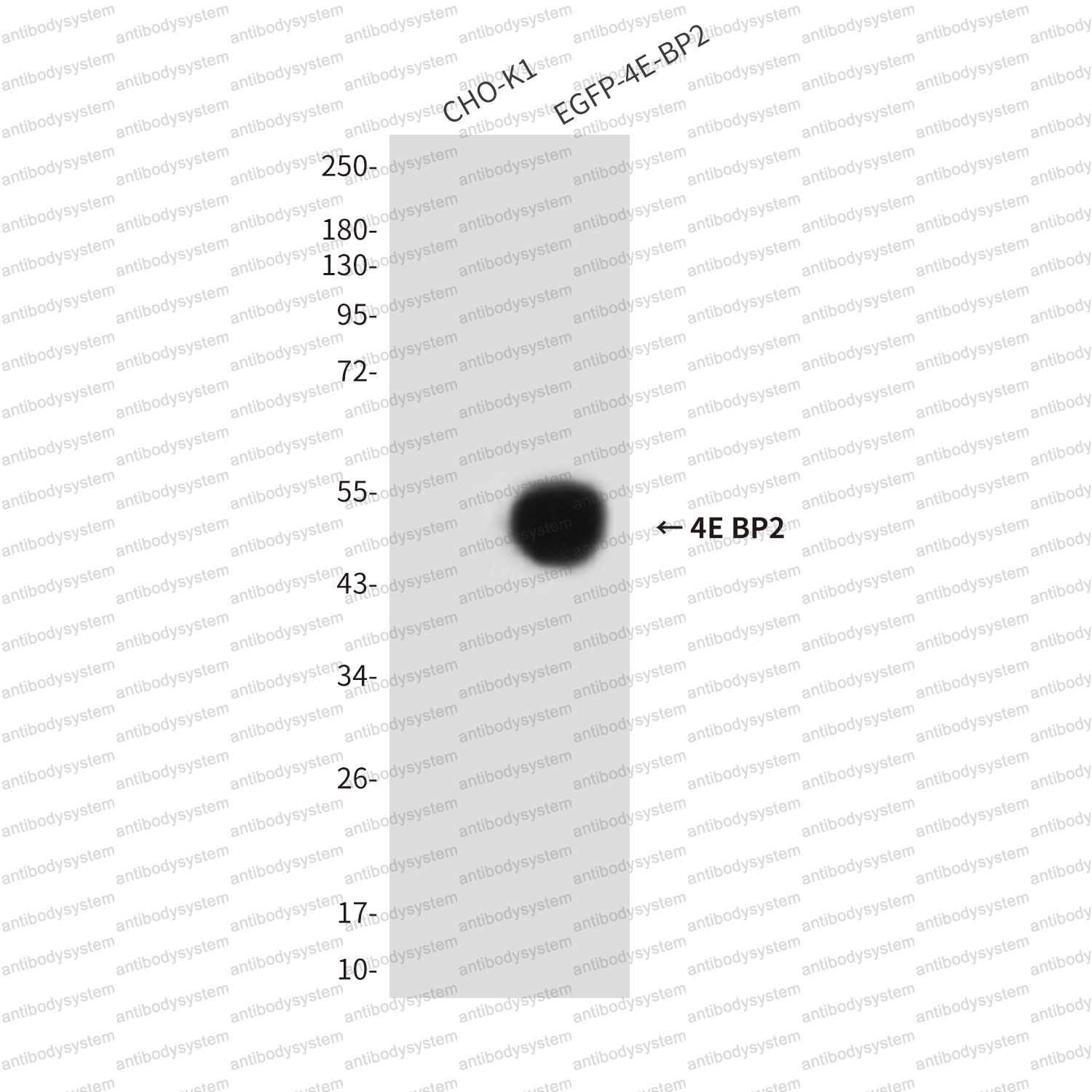 Western blot for Anti-EIF4EBP2/4E-BP2 Antibody (R3S68) ?>