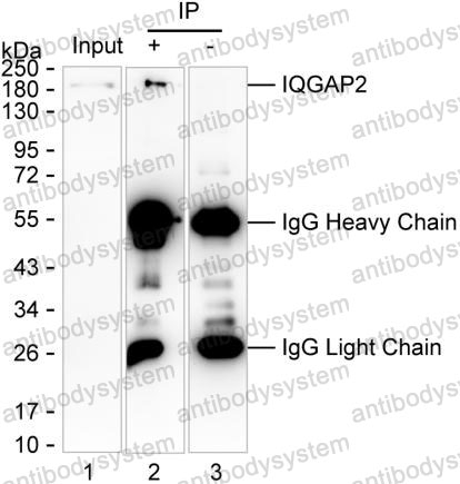 Anti-IQGAP2 Antibody (R3S84)