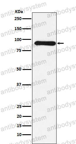 Anti-CUL1 Antibody (R2E76)