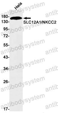 Anti-SLC12A1 Antibody (R2E86)