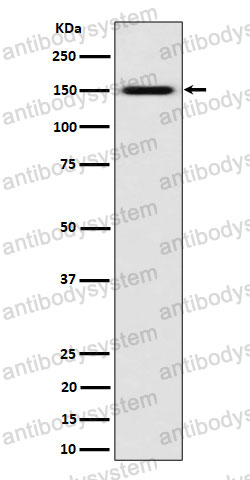 Anti-SLC12A1 Antibody (R2E85)