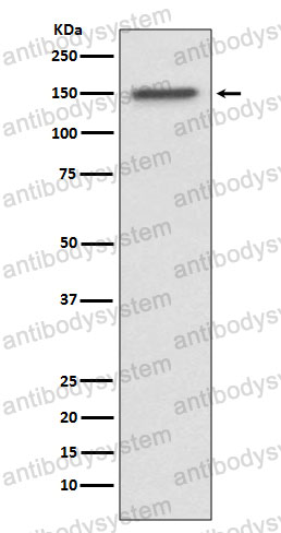 Anti-TP53BP2 Antibody (R2E87)