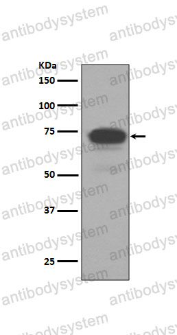 Anti-TPBG/5T4 Antibody (R1B30)
