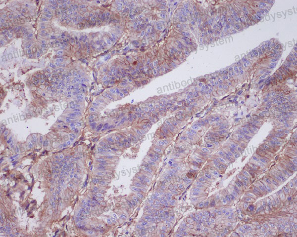 Anti-TPBG/5T4 Antibody (R2E88)