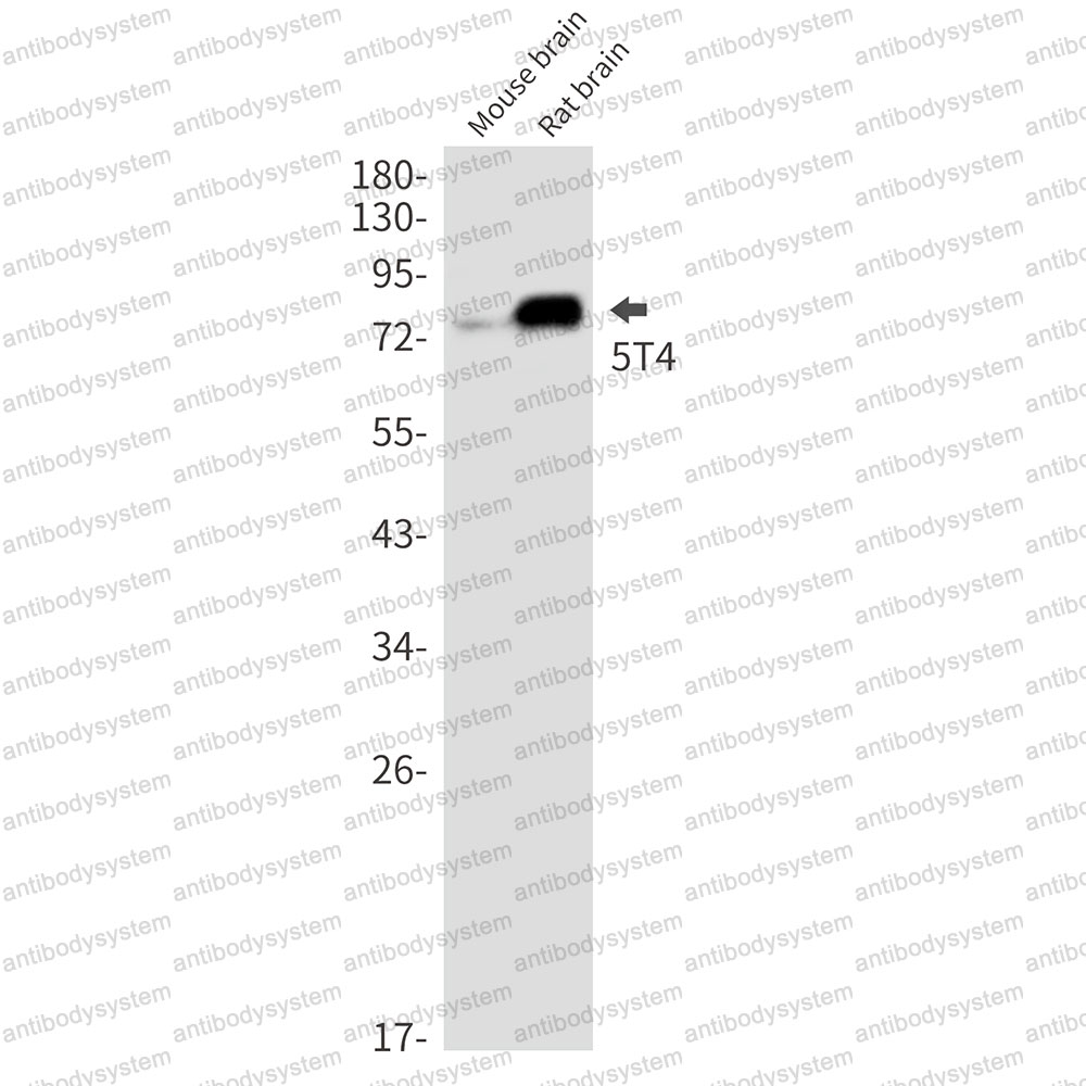Anti-TPBG/5T4 Antibody (R2E89)