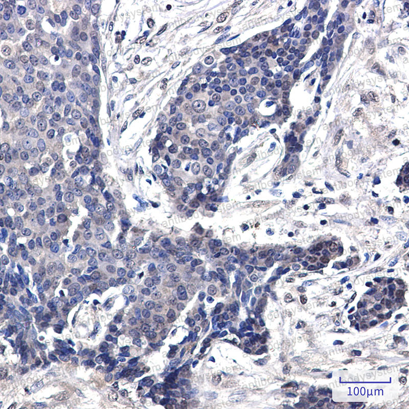 Anti-FHL1 Antibody (R2E91)