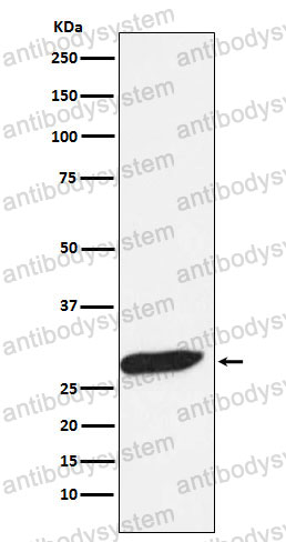 Anti-FHL1 Antibody (R2E90)
