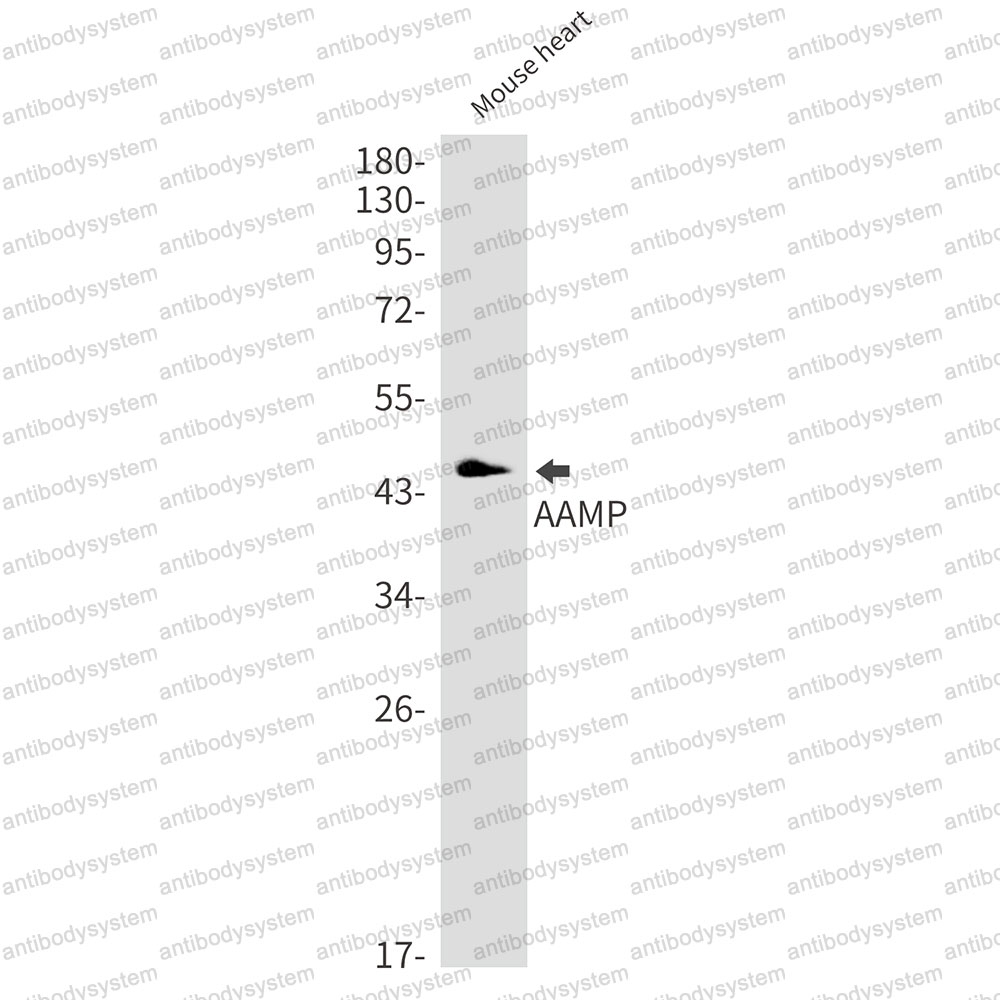 Anti-AAMP Antibody (R2E93)