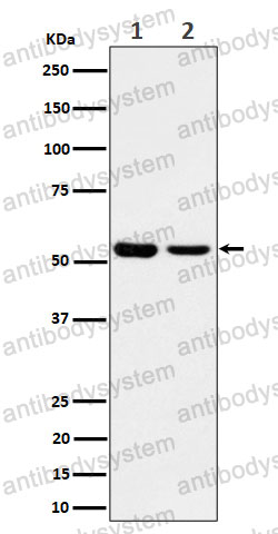 Anti-AAMP Antibody (R2E92)