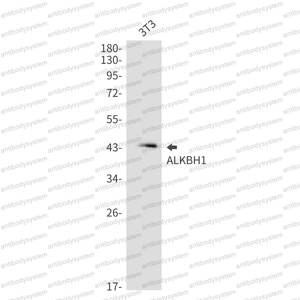 Anti-ALKBH1 Antibody (R2E96)