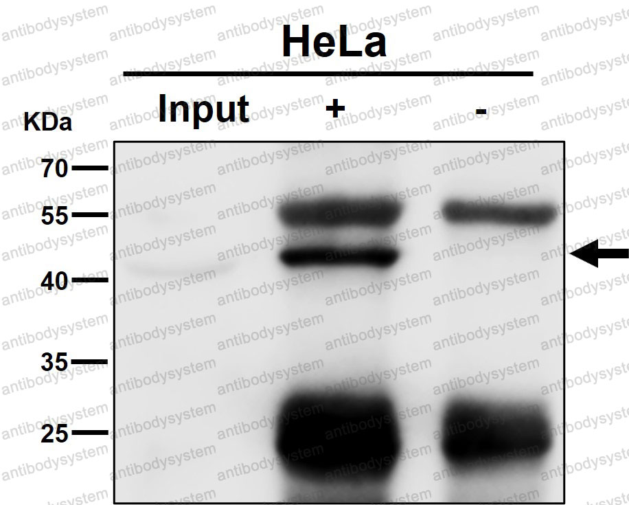 Anti-ALKBH1 Antibody (R2E94)