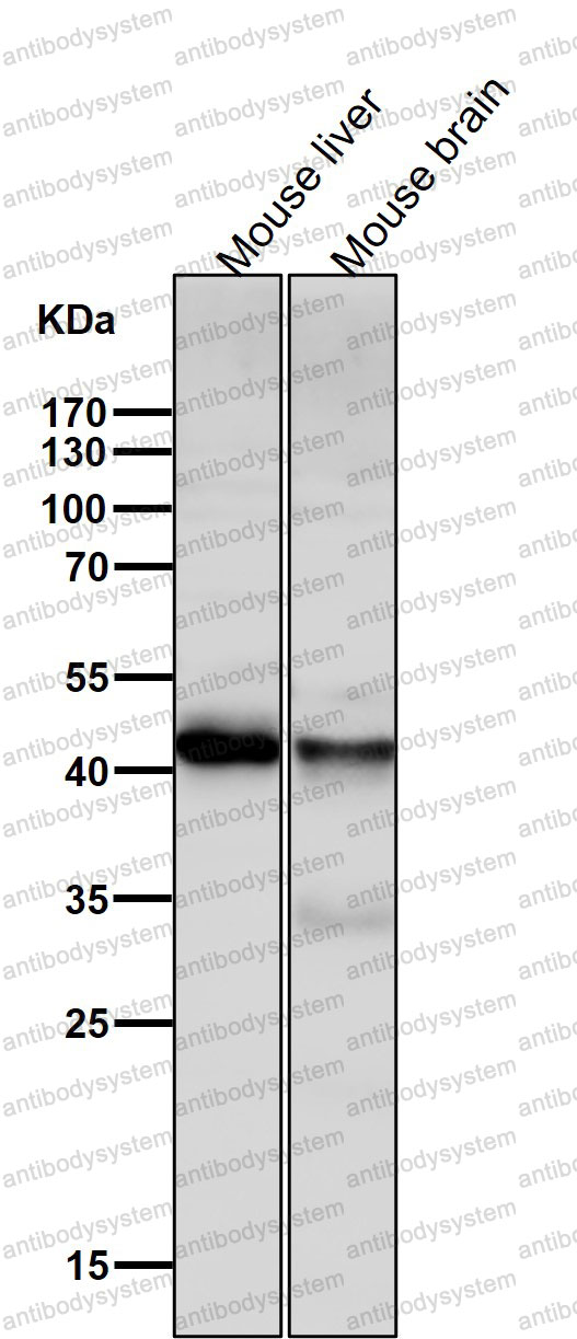 Anti-ALKBH1 Antibody (R2E95)