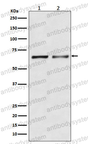 Anti-ACVR2B/ACTR-IIB Antibody (R2E97)