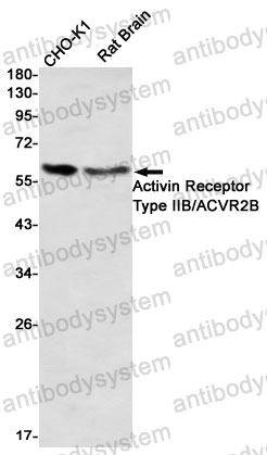 Anti-ACVR2B/ACTR-IIB Antibody (R2E98)