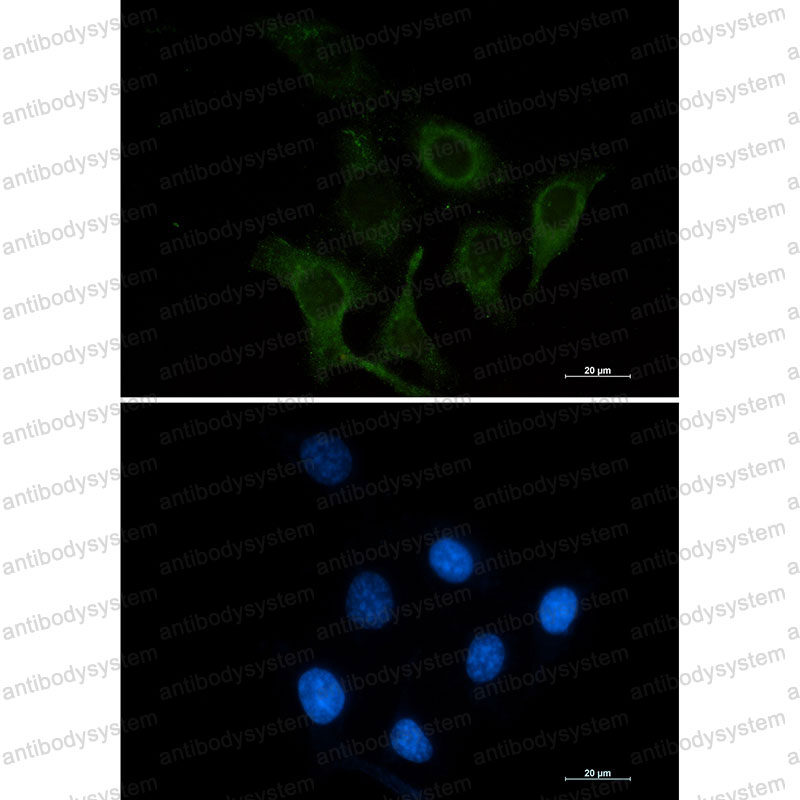 Anti-CD166/ALCAM Antibody (R2E99)