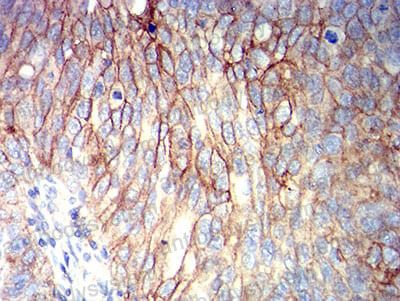 Immunohistochemical for Anti-CD166/ALCAM Antibody (R3S91) ?>