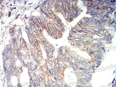 Immunohistochemical for Anti-CD166/ALCAM Antibody (R3S91) ?>