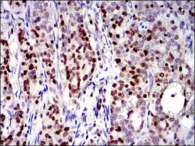 Immunohistochemical for Anti-RUNX3 Antibody (R3S93) ?>
