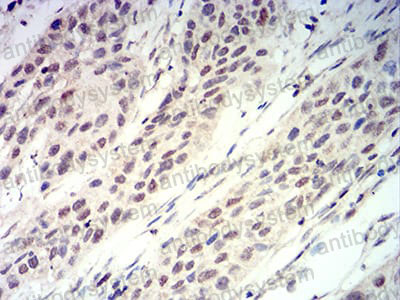 Immunohistochemical for Anti-RUNX3 Antibody (R3S94) ?>