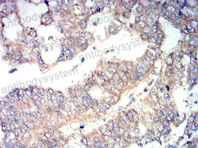 Immunohistochemical for Anti-RUNX3 Antibody (R3S94) ?>