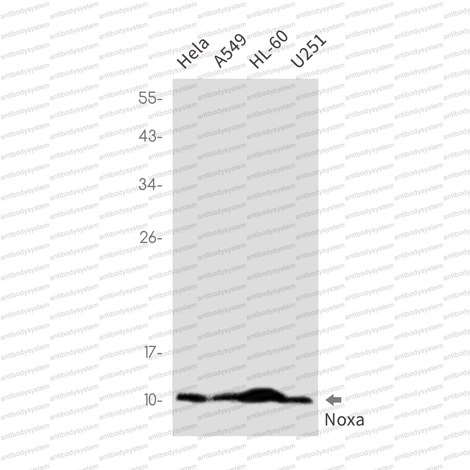 Anti-PMAIP1 Antibody (R2F02)