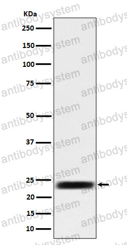 Anti-ARFRP1/ARP Antibody (R2F03)