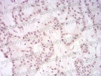 Immunohistochemical for Anti-DDX39B/BAT1/UAP56 Antibody (R3S96) ?>