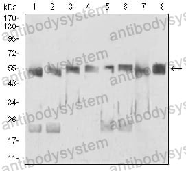 Western blot for Anti-DDX39B/BAT1/UAP56 Antibody (R3S96) ?>