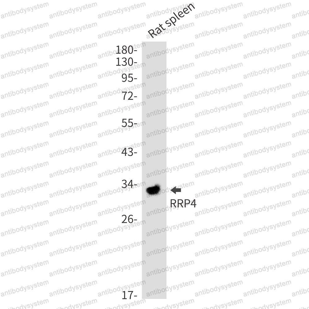 Anti-EXOSC2 Antibody (R2F08)