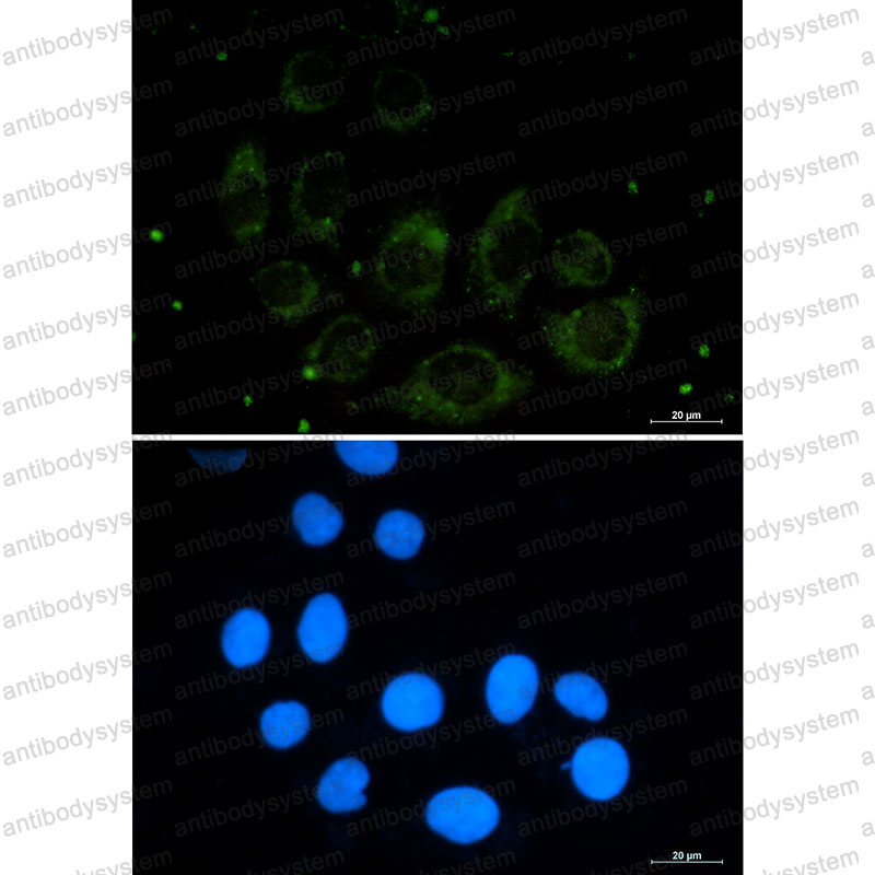 Anti-CUX1 Antibody (R2F09)