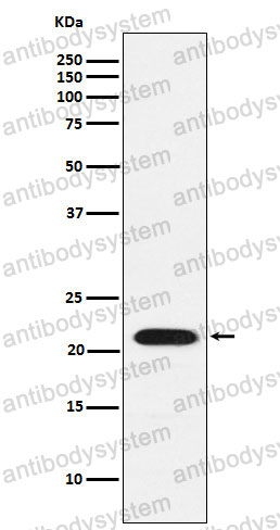 Anti-CBFB Antibody (R2F11)