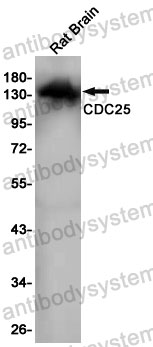 Anti-RASGRF1 Antibody (R2F12)