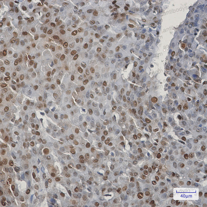 Anti-CIRBP Antibody (R2F13)
