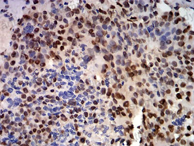 Immunohistochemical for Anti-CIRBP Antibody (R3T04) ?>