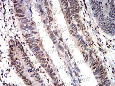 Immunohistochemical for Anti-CIRBP Antibody (R3T04) ?>