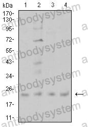 Western blot for Anti-CIRBP Antibody (R3T04) ?>