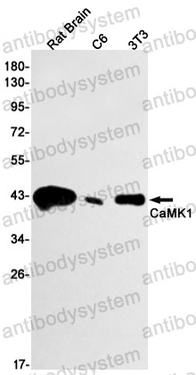 Anti-CAMK1 Antibody (R2F15)