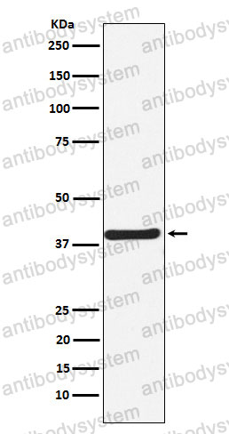 Anti-CAMK1 Antibody (R2F14)