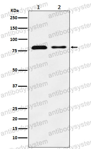 Anti-SCARB2/CD36L2 Antibody (R2F16)