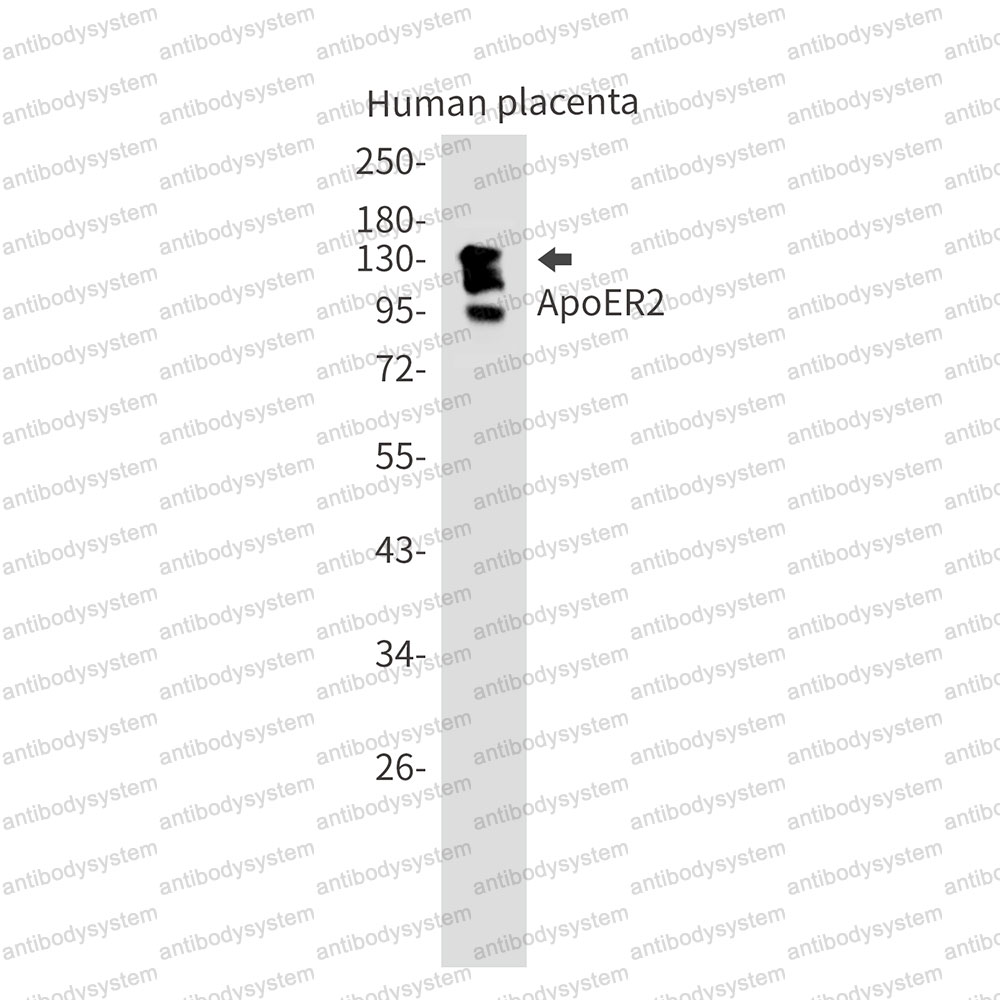 Anti-LRP8 Antibody (R2F17)