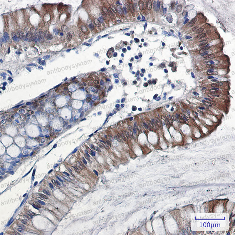 Anti-IL18/IL1F4 Antibody (R2F18)